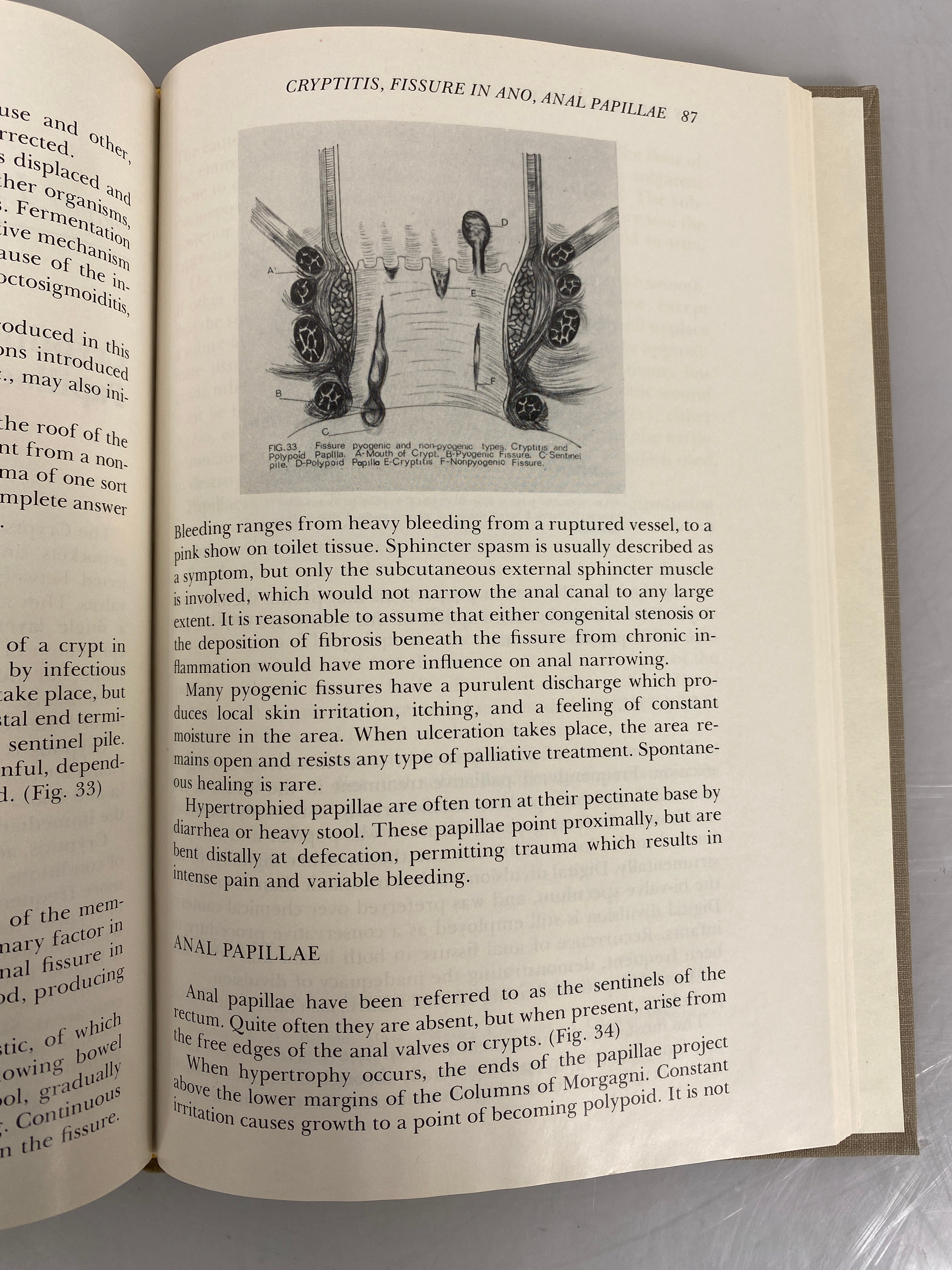 Procto-Basics by Carlton Noll 1978 Illustrated HC