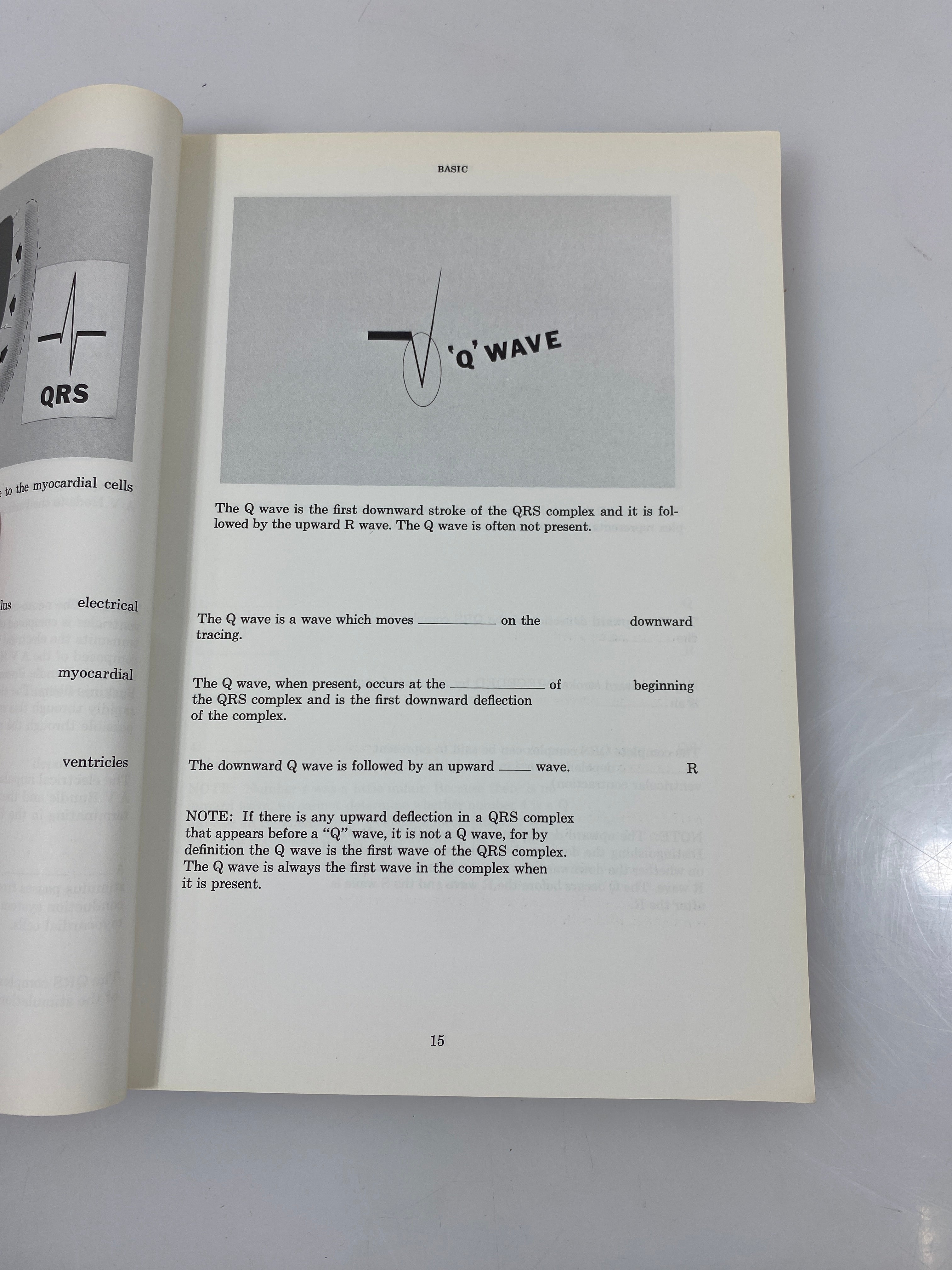 Rapid Interpretation of EKG's by Dubin 1975 SC