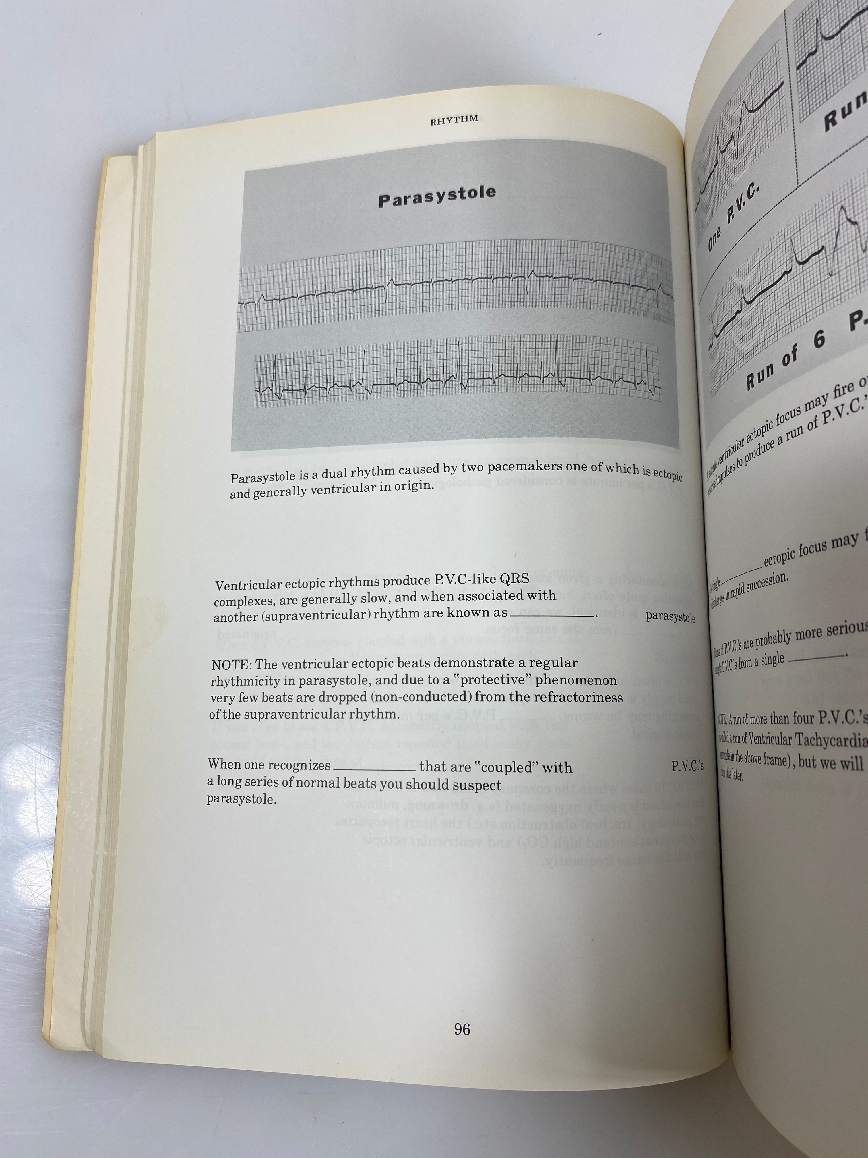 Rapid Interpretation of EKG's by Dubin 1975 SC