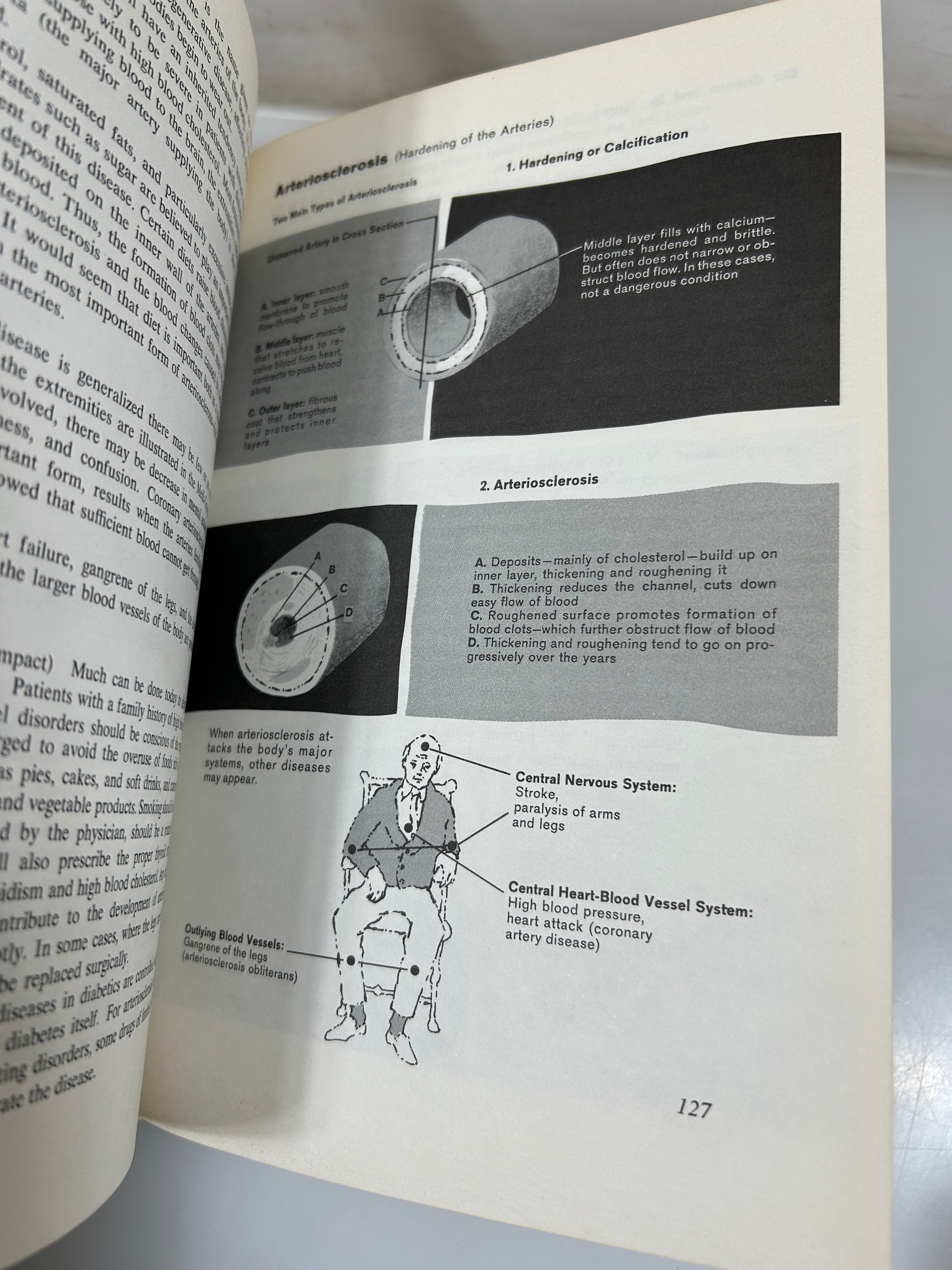 Set of 4 The New Illustrated Medical & Health Encyclopedia Ed Fishbein 1975 HC