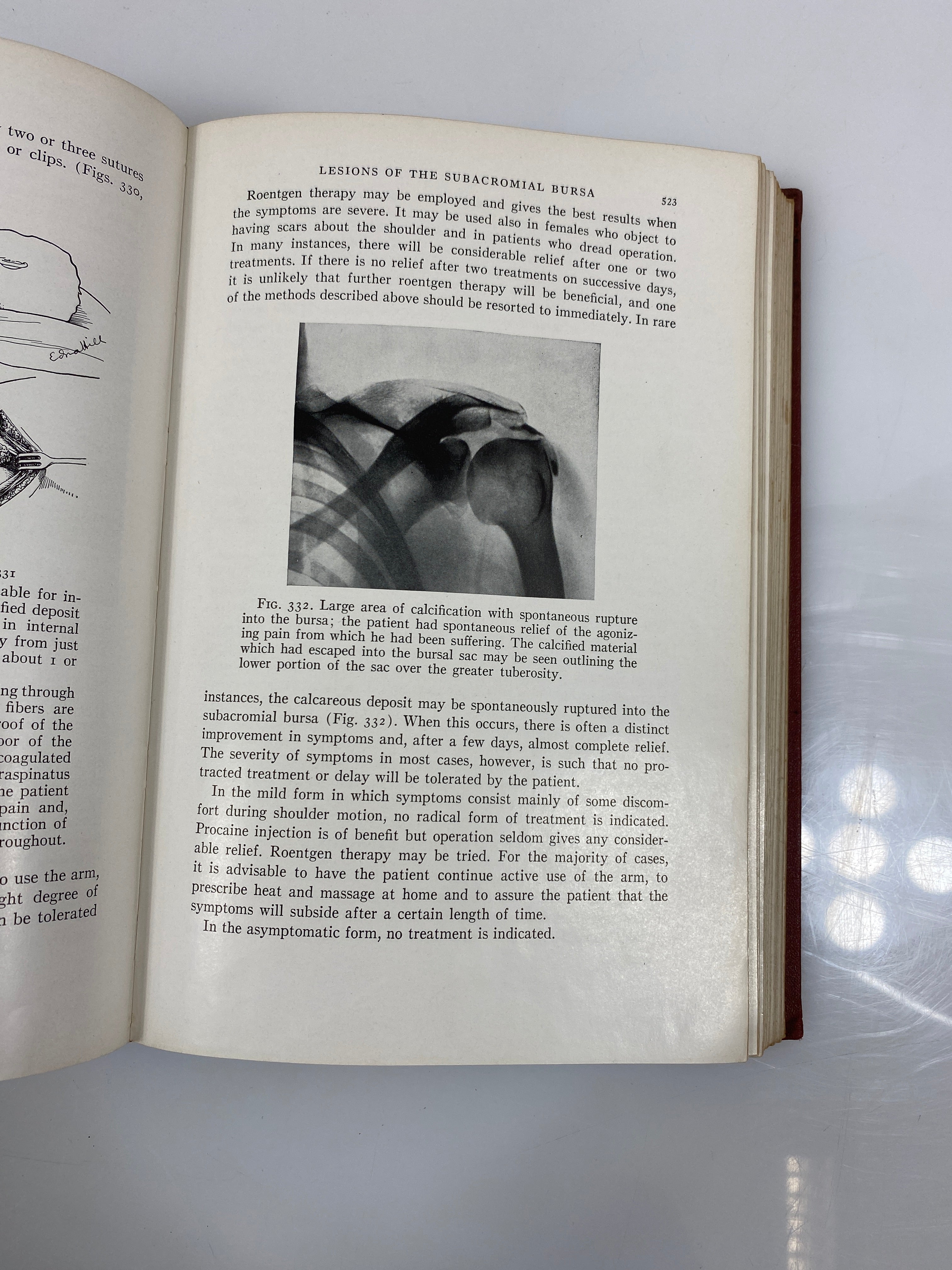 Surgery of the Ambulatory Patient by Ferguson 1942 HC