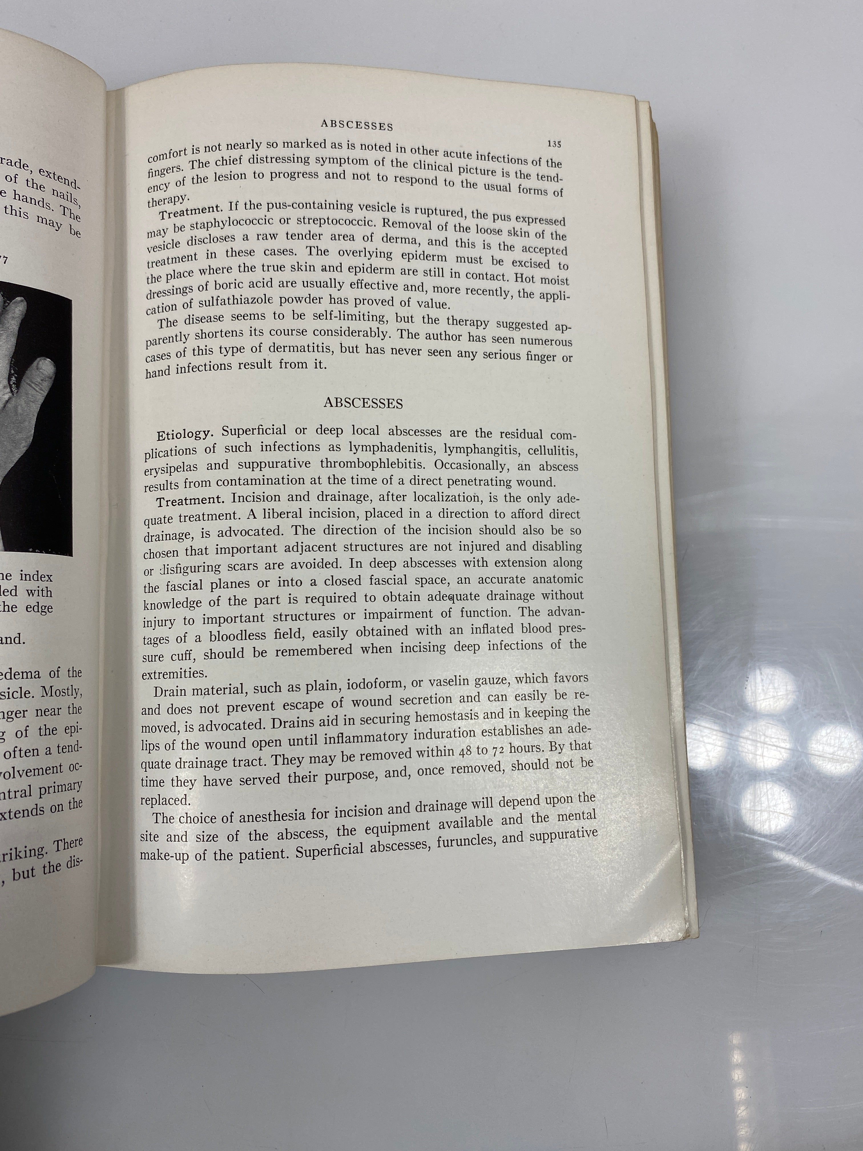 Surgery of the Ambulatory Patient by Ferguson 1942 HC