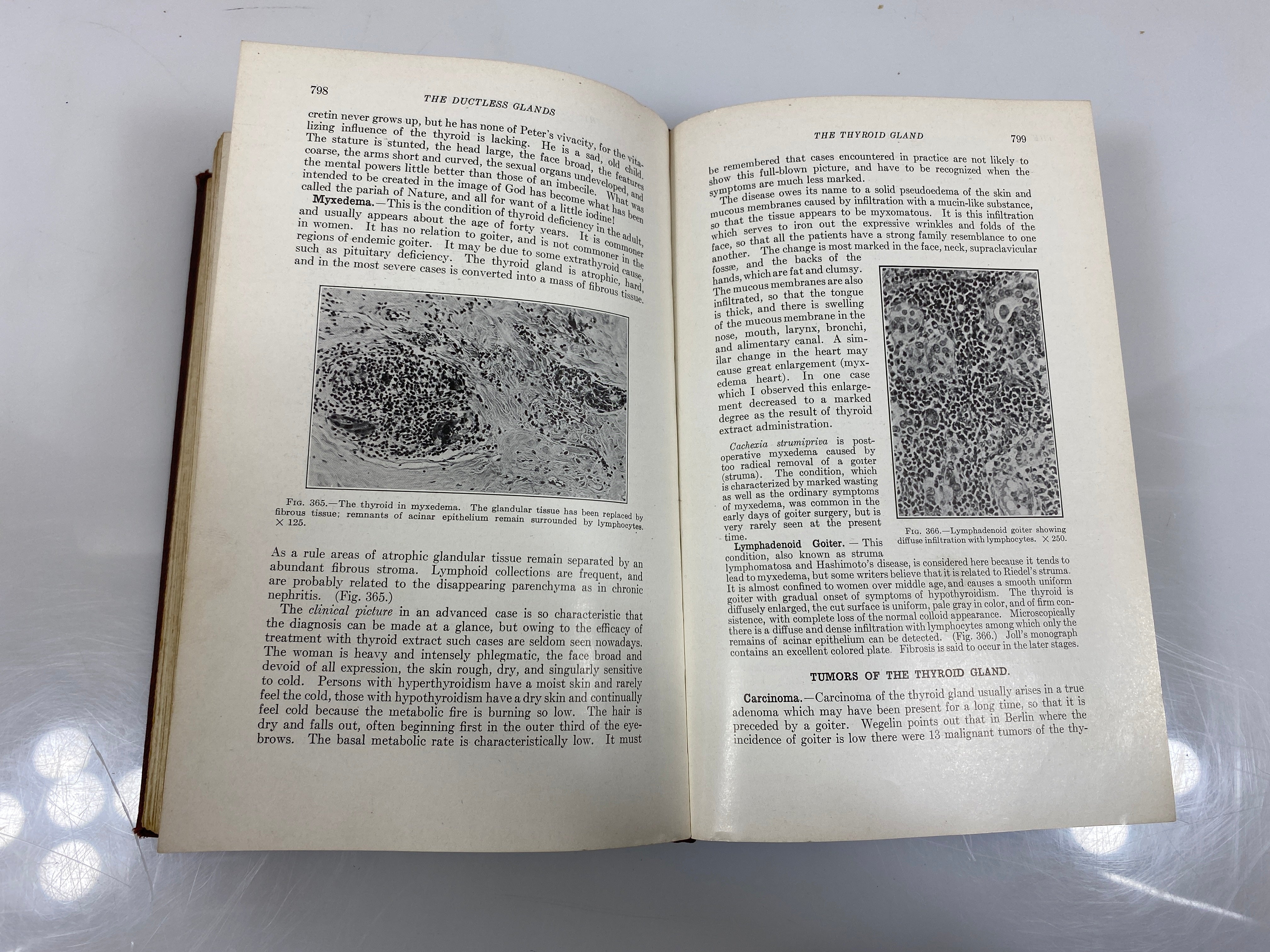 Text-Book of Pathology by Boyd 1941 HC