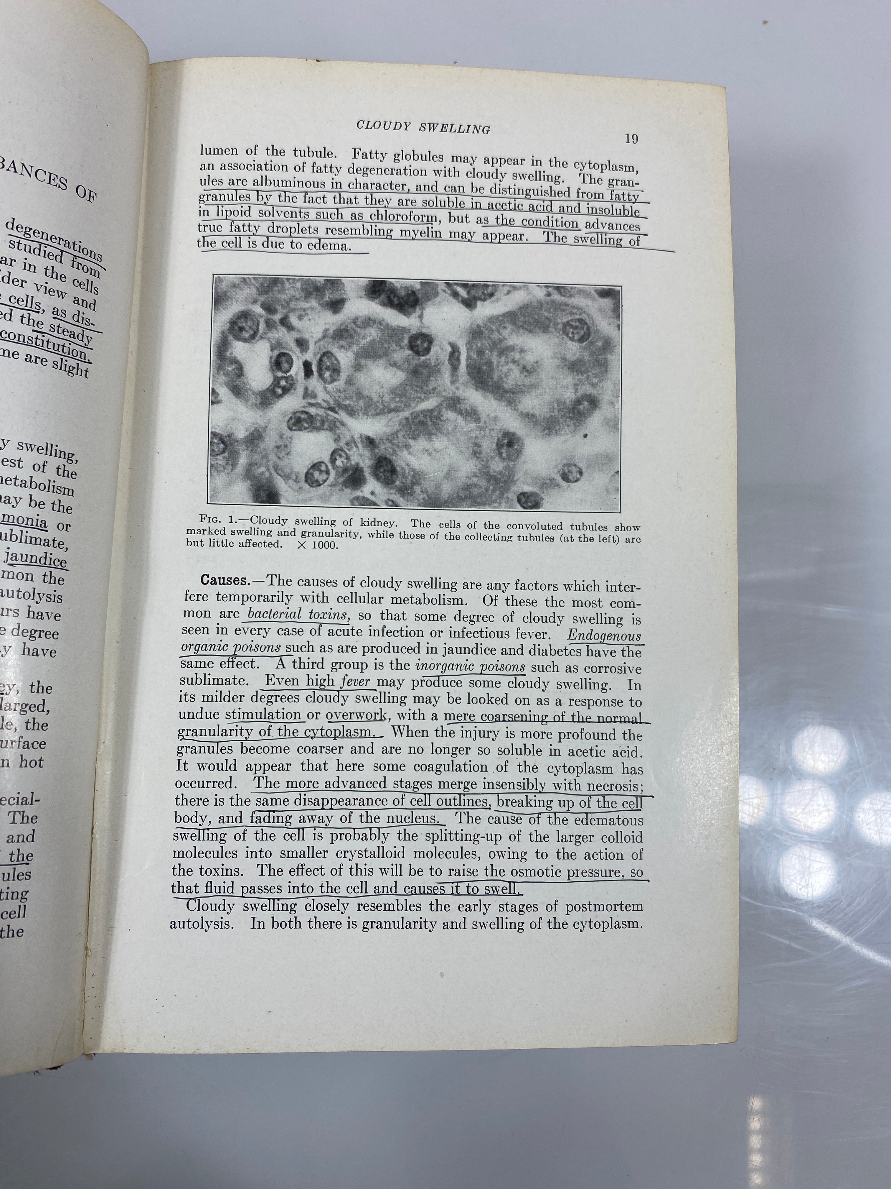 Text-Book of Pathology by Boyd 1941 HC