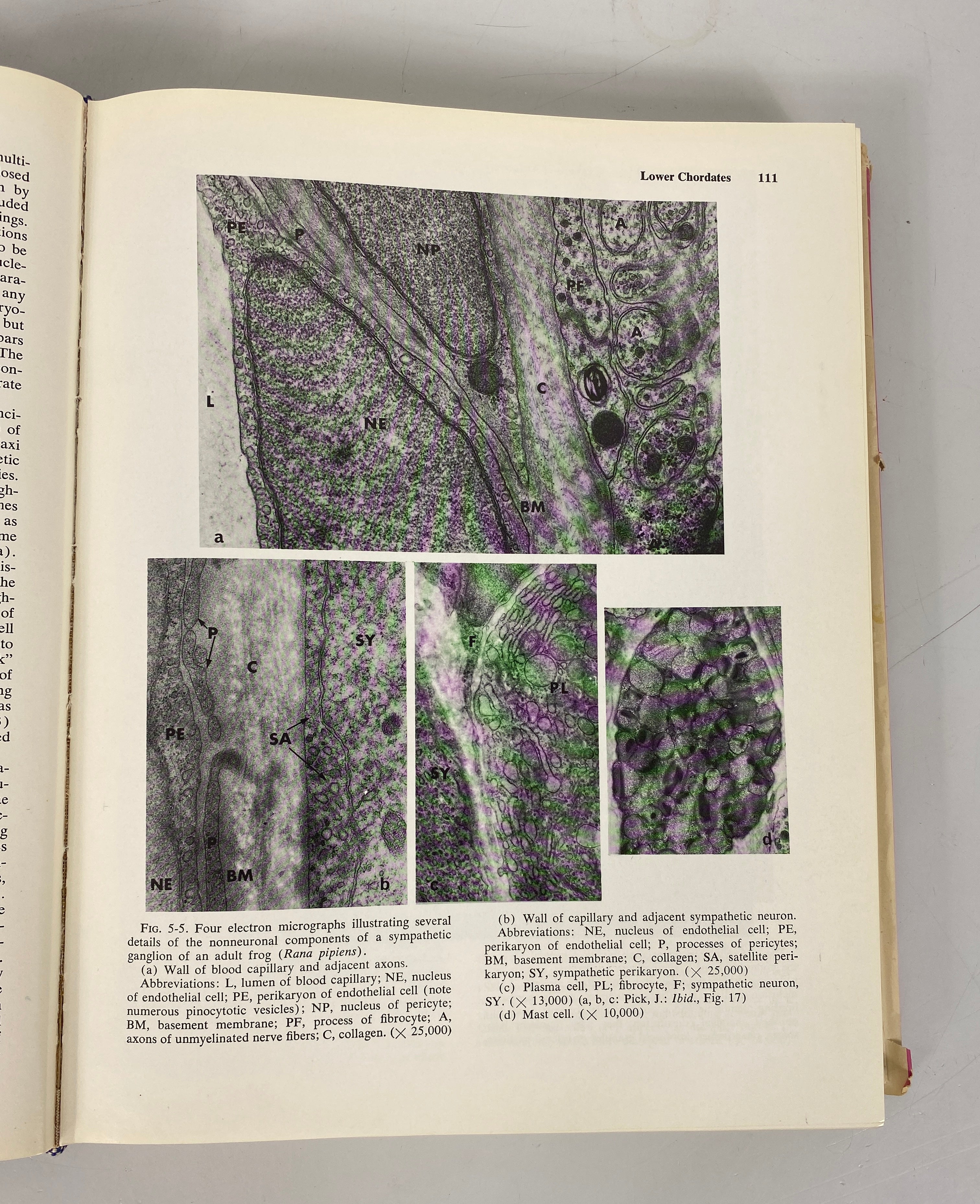 The Autonomic Nervous System Joseph Pick 1970 HCDJ