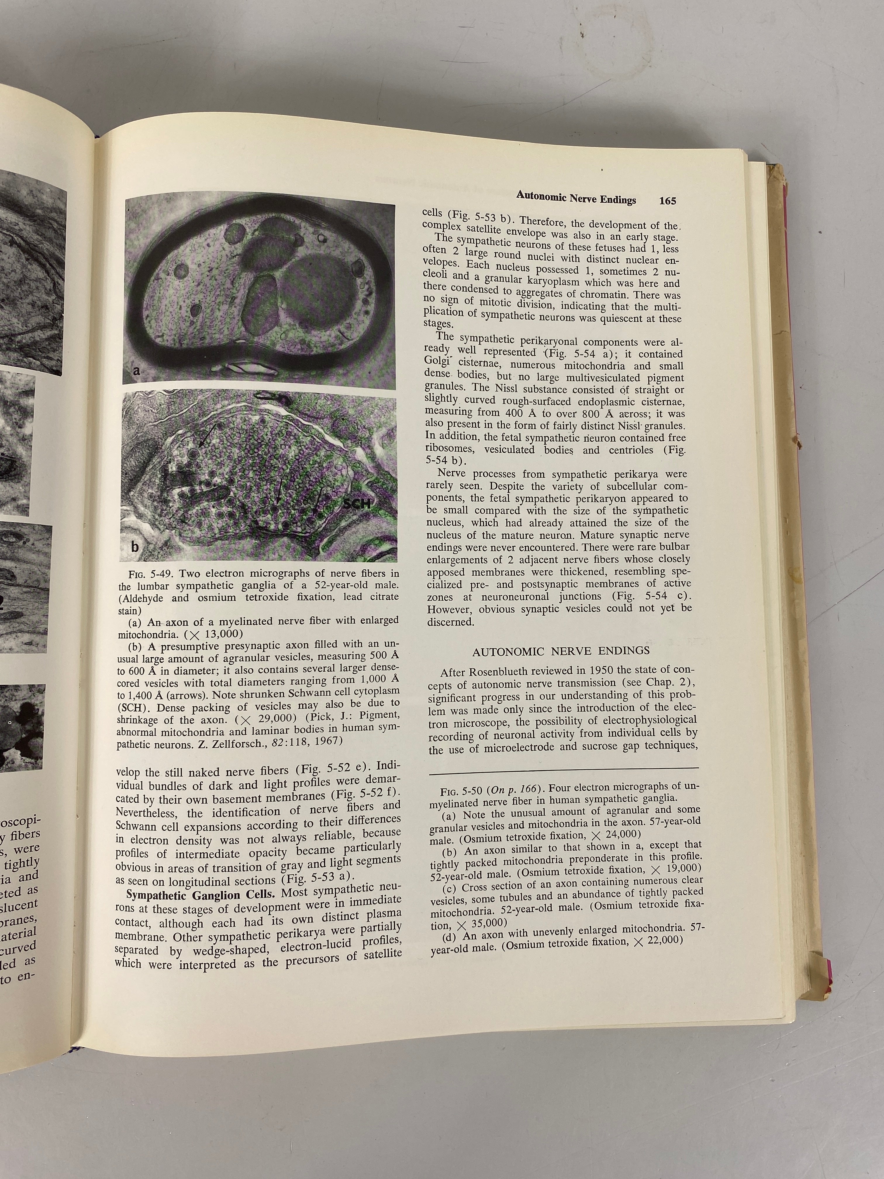 The Autonomic Nervous System Joseph Pick 1970 HCDJ