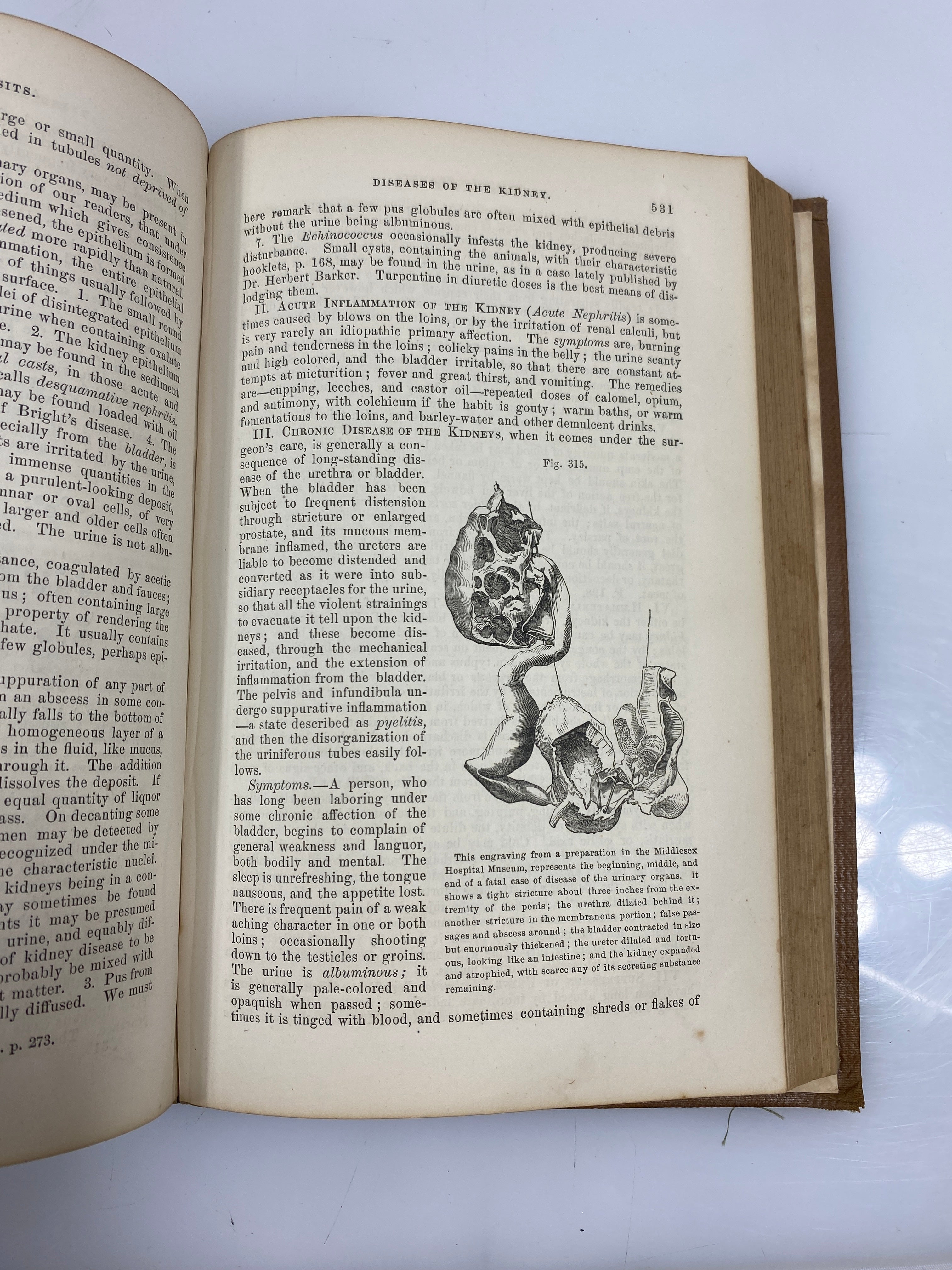 The Principles and Practice of Modern Surgery by Druitt 1860 HC